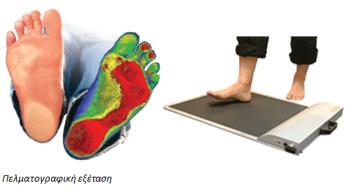 ΔΩΡΕΑΝ Εξέταση Ανάλυσης Βαδίσματος για τους πολίτες του Δήμου Αιγάλεω