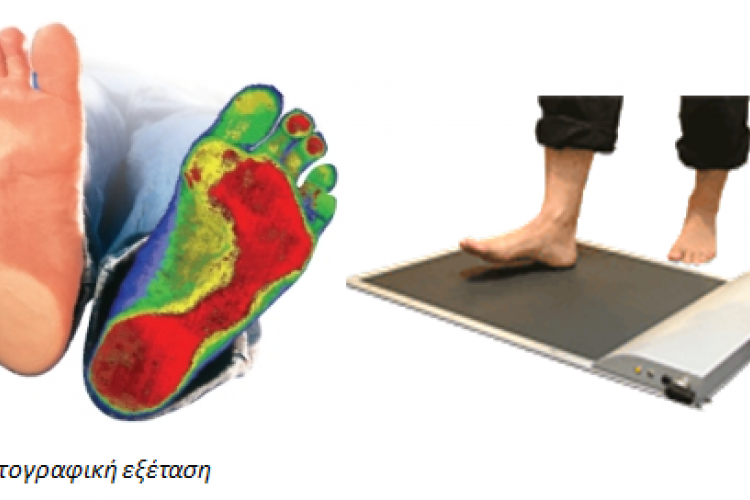 ΔΩΡΕΑΝ Εξέταση Ανάλυσης Βαδίσματος για τους πολίτες του Δήμου Αιγάλεω